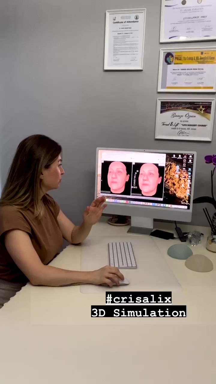 3D Simulation Consultation at the Clinic